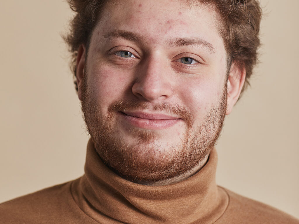 Junger Mann mit unreiner Haut