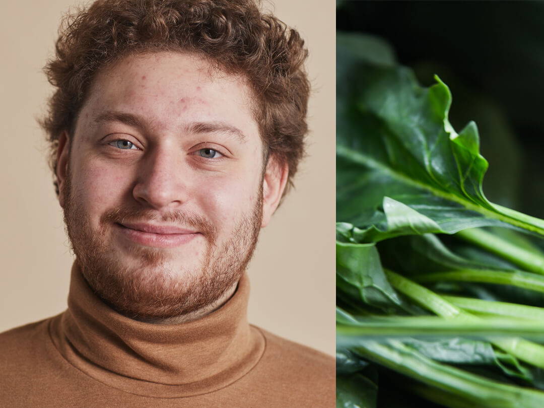 Ernährung gegen Pickel: So wirst du Unreinheiten los