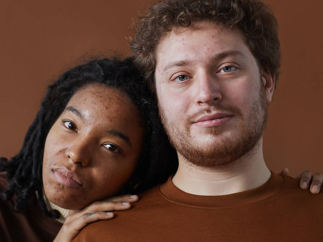 Schwarzkümmelöl Wirkung auf die Haut