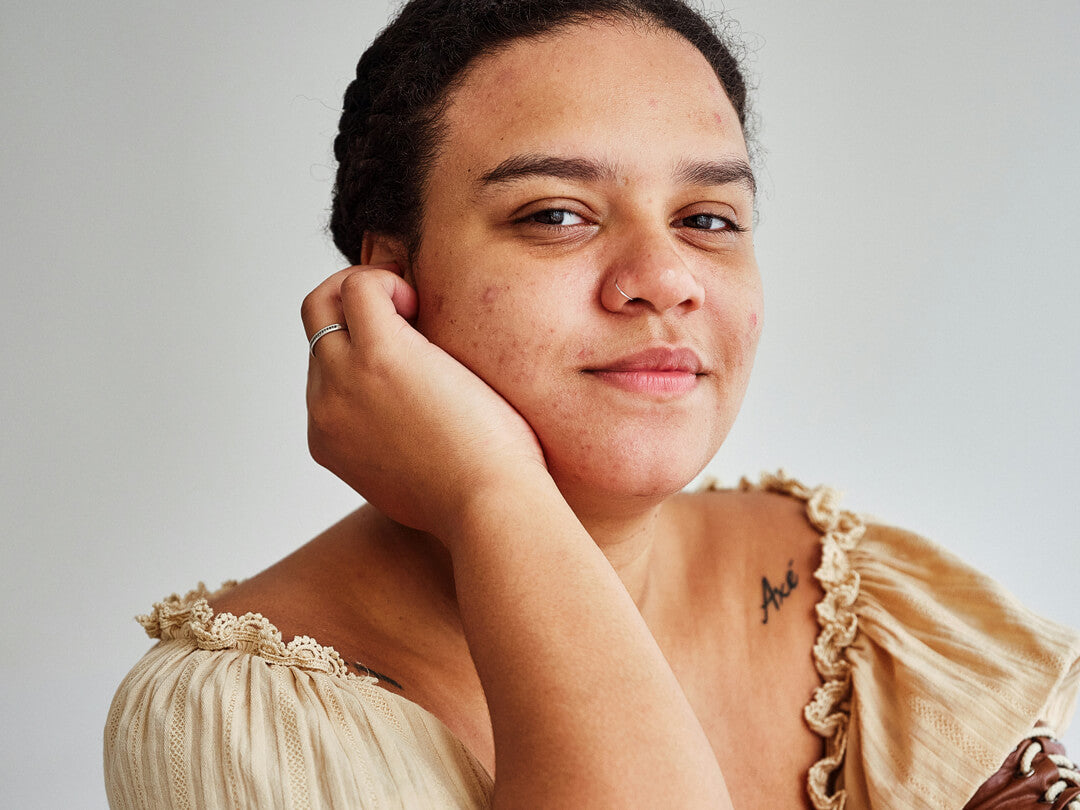 Frau mit Hautproblemen im Gesicht